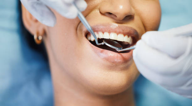 Best Emergency Dentist for Knocked-Out Tooth in Longview, TX